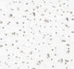 THERMATEX® Mercure Complete